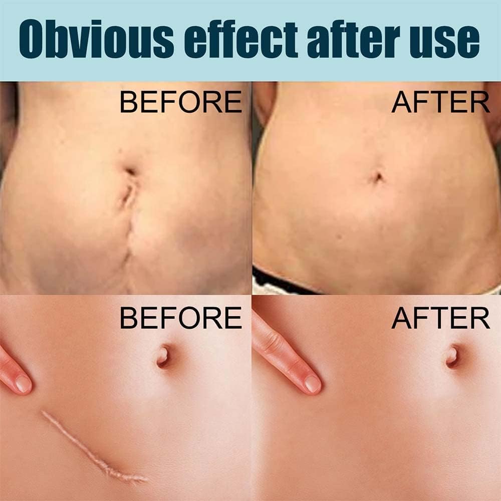 German Advanced Skin Renewal Gel