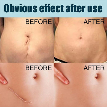 German Advanced Skin Renewal Gel